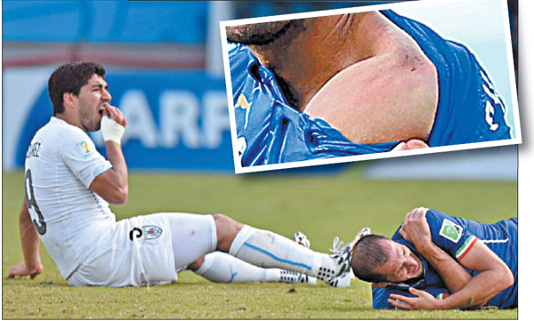 Uruguay-striker-Luis-Suarez-bites-Giorgio-Chiellini